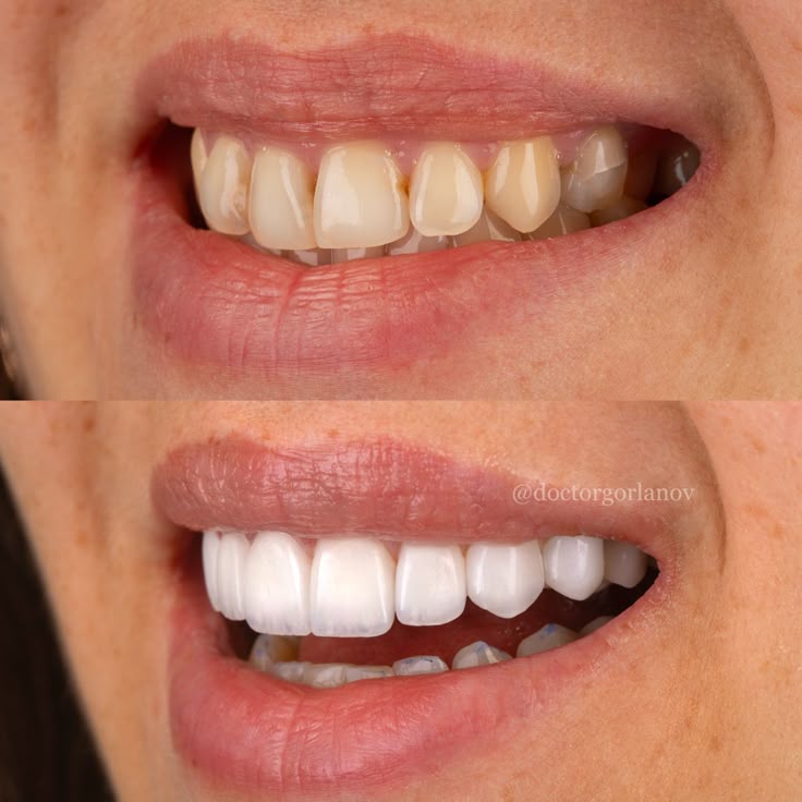 MiswakWash XXL 250ml